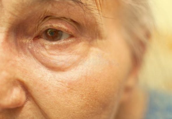 old-woman-face-29578324-1-1